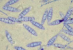 Dermatophyte Identification Chart