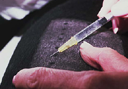 Photo of injecting allergen into the dermis