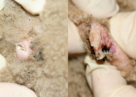 Photo of cyst