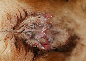 Photo of fistula